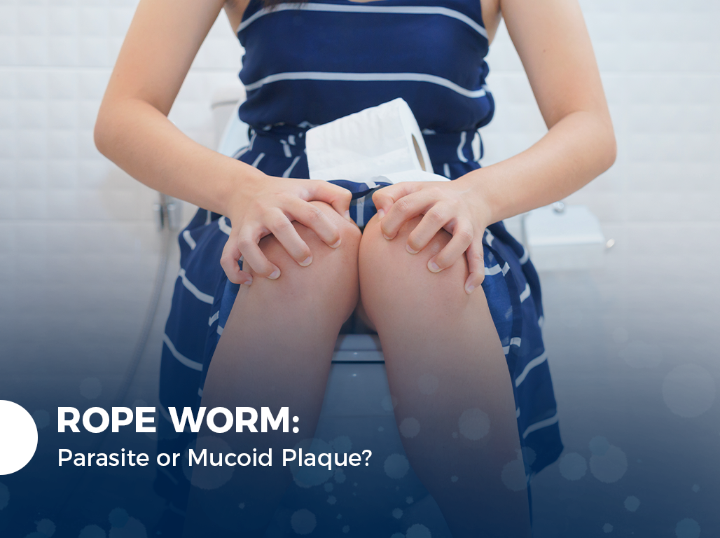 Rope Worm: Parasite or Mucoid Plaque